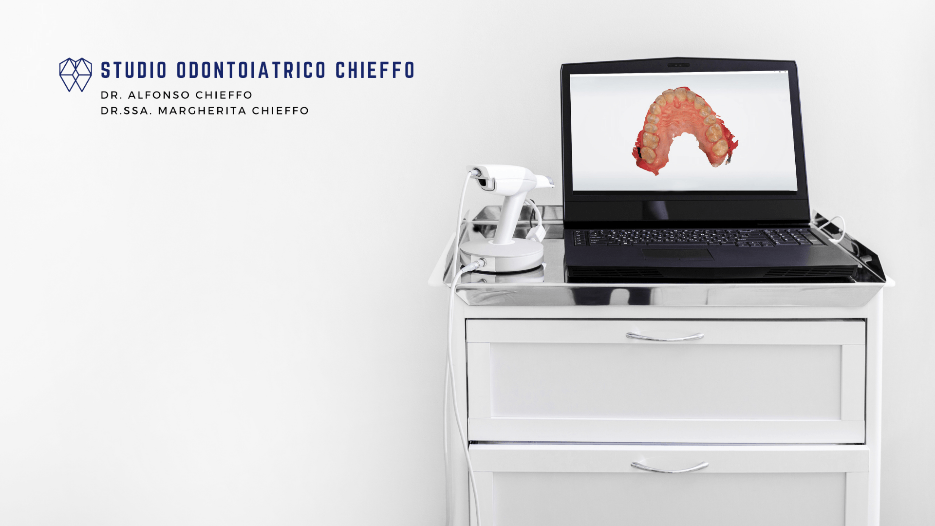 Apparecchiatura dello Studio con visualizzazione digitale di un’impronta dentale